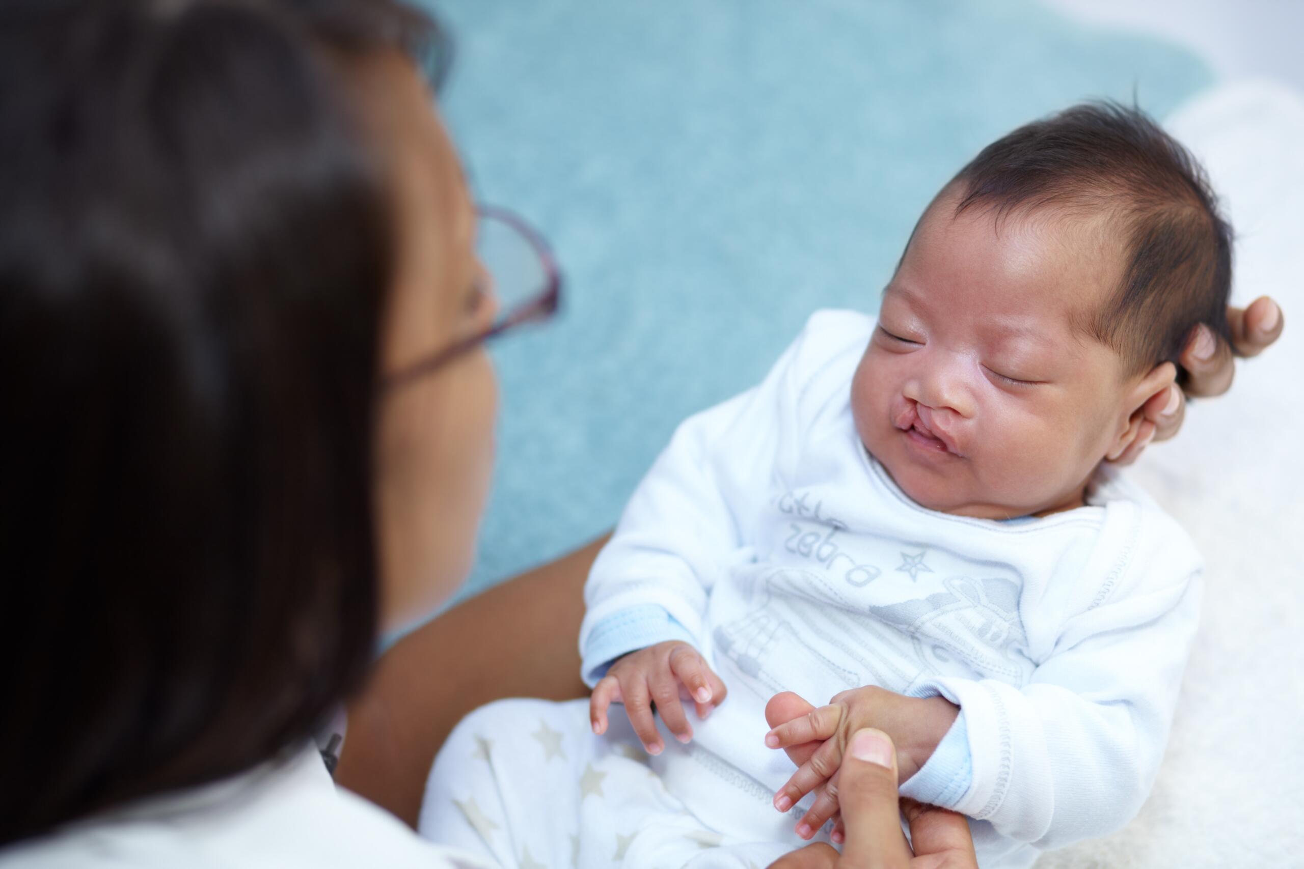 Understanding Cleft Lip and Cleft Palate Causes, Symptoms, and Treatment