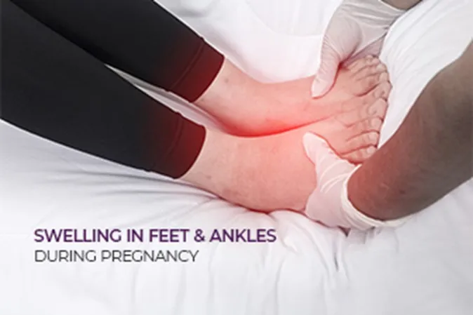 Common Issues During Pregnancy – Swelling in Feet and Ankles