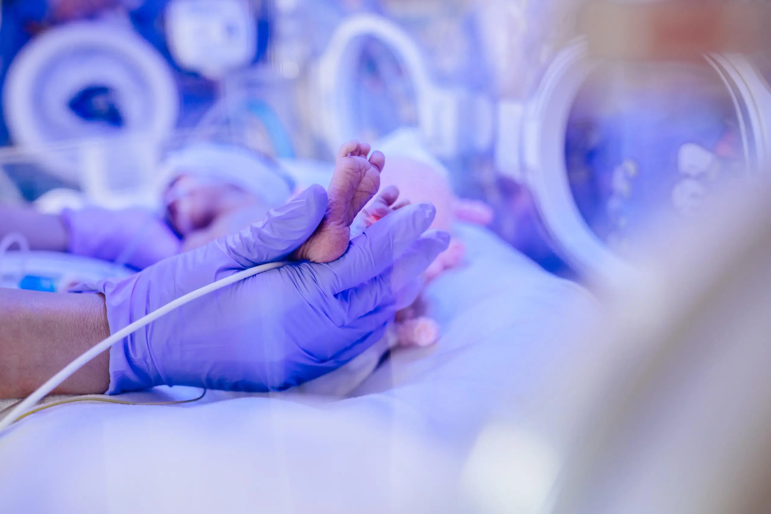 Advantages of Having a Baby in the Neonatal Intensive Care Unit (NICU)