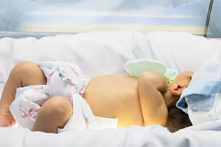 Newborn Jaundice: Causes, Symptoms and Treatment