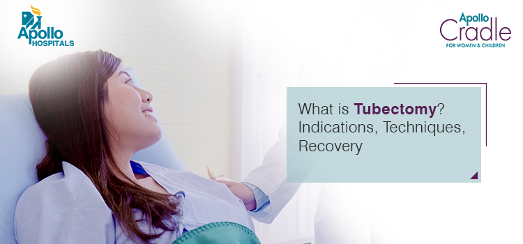 What is Tubectomy, Indications, Techniques, Recovery